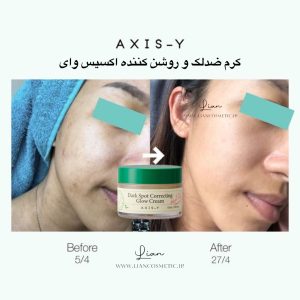 کرم آبرسان ضد لک و روشن کننده اکسیس وای 2% آلفاآربوتین+ 5% نیاسینامید لیان کازمتیک | خرید محصولات آرایشی و مراقبت پوست اورجینال